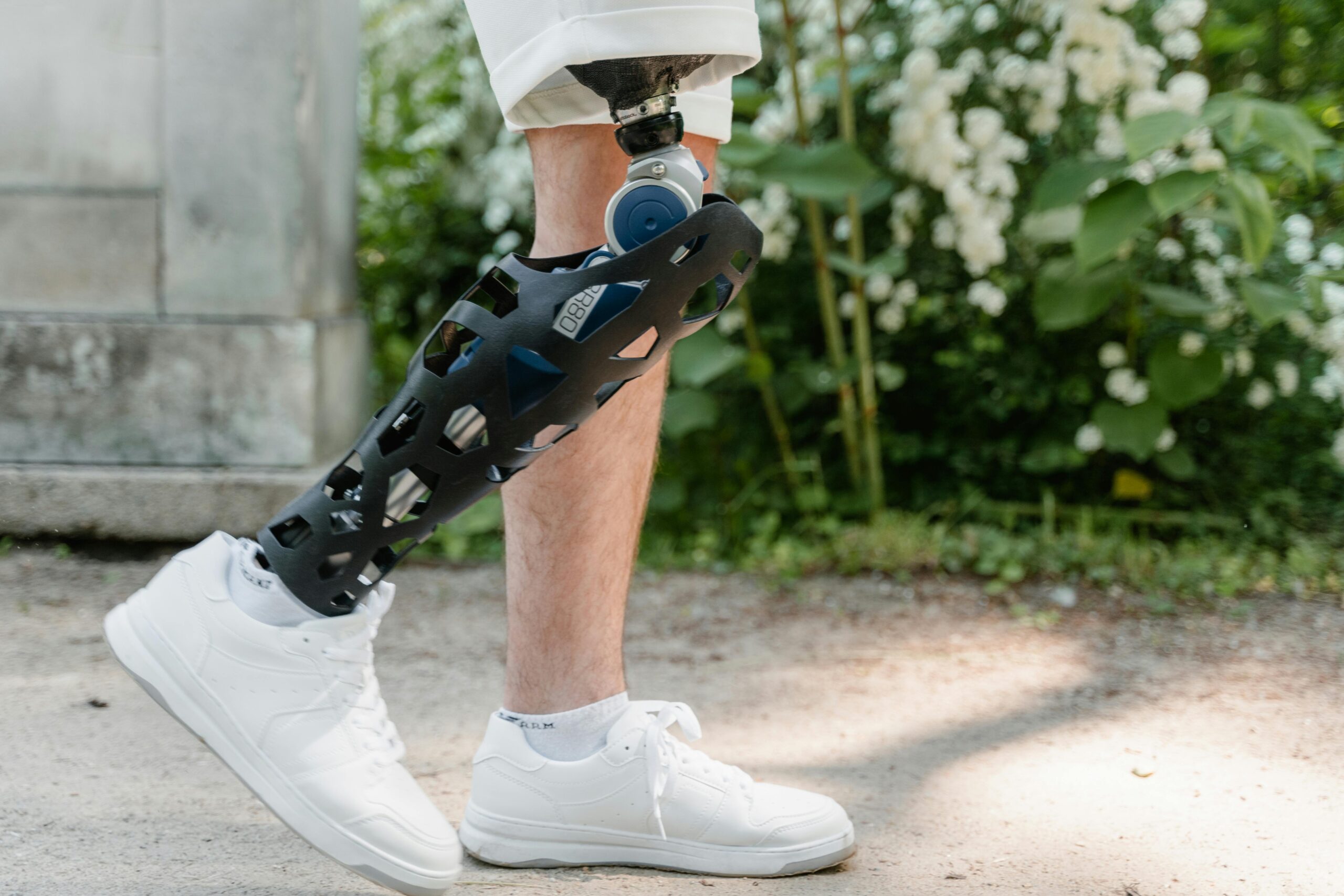 Close-up of a person with a prosthetic leg walking outside in sneakers, showcasing mobility.